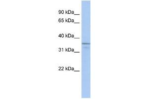 WB Suggested Anti-UBLCP1 Antibody Titration: 0. (UBLCP1 Antikörper  (N-Term))