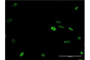 Immunofluorescence of monoclonal antibody to DLX2 on HeLa cell. (DLX2 Antikörper  (AA 1-124))