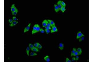 Immunofluorescence staining of HepG2 cells with ABIN7173382 at 1:166, counter-stained with DAPI. (TREM2 Antikörper  (AA 19-174))