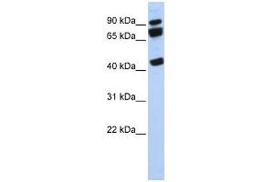 WB Suggested Anti-DDX17 Antibody Titration:  0. (DDX17 Antikörper  (N-Term))