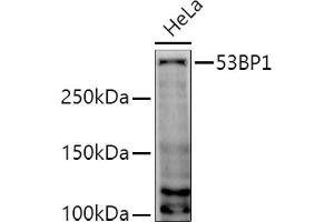 Western blot analysis of extracts of HeLa cells, using 53BP1 antibody (ABIN6128833, ABIN6149414, ABIN6149415 and ABIN6221431) at 1:1000 dilution. (TP53BP1 Antikörper  (AA 1763-1977))