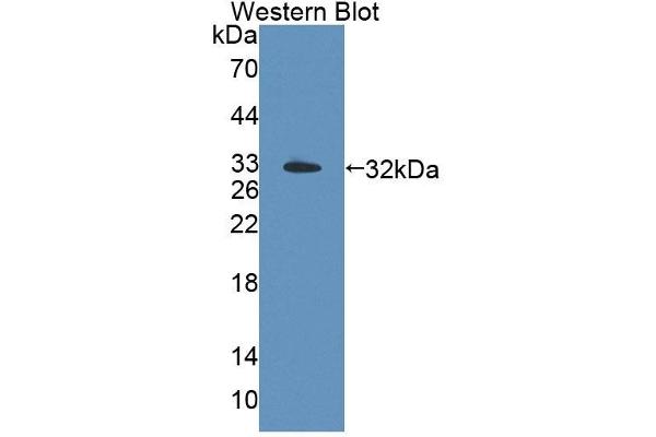 TOP3B Antikörper  (AA 1-250)