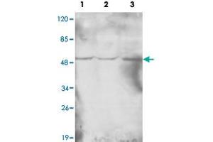 Western blot analysis of HAT1 monoclonal antibody  at 1 : 1000 dilution. (HAT1 Antikörper  (N-Term))