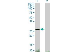 Western Blotting (WB) image for anti-Cbp/p300-Interacting Transactivator, with Glu/Asp-Rich Carboxy-terminal Domain, 1 (CITED1) (AA 1-193) antibody (ABIN518019)