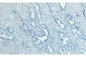 Immunohistochemistry (IHC) image for anti-Dual Specificity Phosphatase 1 (DUSP1) (C-Term) antibody (ABIN184638)