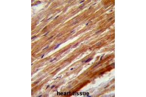 Immunohistochemistry (Paraffin-embedded Sections) (IHC (p)) image for anti-Mitogen-Activated Protein Kinase Kinase Kinase 4 (MAP3K4) (AA 1065-1097), (Middle Region) antibody (ABIN953298)