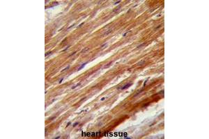 Formalin fixed and paraffin embedded human heart stained with MEKK4 Antibody (Center) Cat. (MAP3K4 Antikörper  (Middle Region))