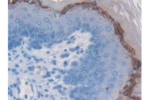 DAB staining on IHC-P; Samples: Mouse Esophagus Tissue (WFDC5 Antikörper  (AA 1-126))