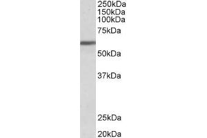 ABIN185457 (1µg/ml) staining of Human Breast cancer lysate (35µg protein in RIPA buffer). (ZNF703 Antikörper  (Internal Region))
