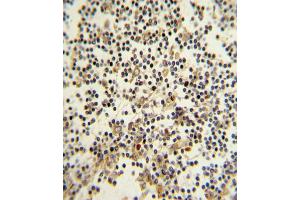 Formalin-fixed and paraffin-embedded human lymph with CD82 (ST6) Antibody (C-term), which was peroxidase-conjugated to the secondary antibody, followed by DAB staining. (CD82 Antikörper  (C-Term))