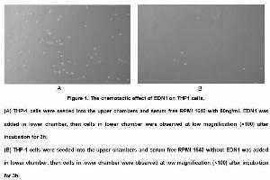 Image no. 3 for Endothelin 1 (EDN1) (AA 54-202) (Active) protein (His tag) (ABIN6239857) (Endothelin 1 Protein (EDN1) (AA 54-202) (His tag))