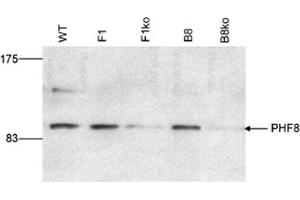 Western Blot results of Rabbit anti-PHF8 antibody Western Blot results of Rabbit anti-PHF8 antibody. (PHF8 Antikörper)