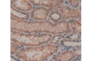 IHC-P analysis of kidney tissue, with DAB staining. (AGRN Antikörper  (AA 1329-1548))