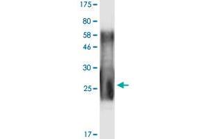Image no. 2 for Tumor Necrosis Factor (Ligand) Superfamily, Member 11 (TNFSF11) (AA 158-317) protein (His-DYKDDDDK-Strep II Tag) (ABIN1323211) (RANKL Protein (AA 158-317) (His-DYKDDDDK-Strep II Tag))