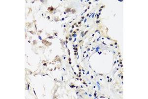 Immunohistochemistry of paraffin-embedded human lung using C antibody (ABIN7266546) at dilution of 1:100 (40x lens). (CAND1 Antikörper  (AA 750-980))