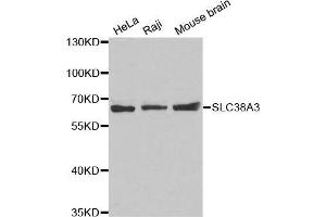 Western blot analysis of extracts of various cell lines, using SLC38A3 antibody. (SLC38A3 Antikörper  (AA 1-65))