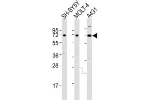 All lanes : Anti-HTR2C Antibody (Center) at 1:4000 dilution Lane 1: SH-SY5Y whole cell lysates Lane 2: MOLT-4 whole cell lysates Lane 3: A431 whole cell lysates Lysates/proteins at 20 μg per lane. (HTR2C Antikörper  (AA 274-308))