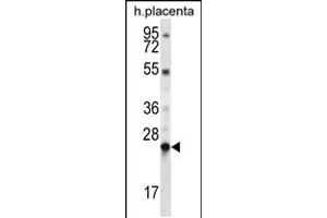 Western blot analysis in human placenta tissue lysates (35ug/lane). (LHFPL1 Antikörper  (N-Term))