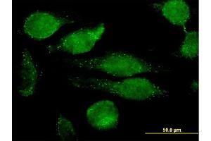 Immunofluorescence of monoclonal antibody to GRN on HeLa cell.