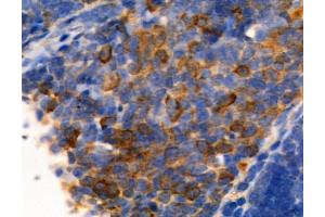 ABIN6261455 and ABIN6277691 at 1/100 staining Mouse thymus tissue by IHC-P. (Ephrin B2 Antikörper  (C-Term))