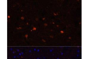 Immunofluorescence analysis of Mouse brain using S100B Polyclonal Antibody at dilution of 1:100. (S100B Antikörper)