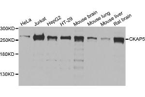 Western blot analysis of extracts of various cell lines, using CKAP5 antibody. (CKAP5 Antikörper)