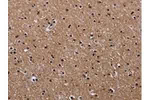 The image on the left is immunohistochemistry of paraffin-embedded Human brain tissue using ABIN7128956(CLDND1 Antibody) at dilution 1/50, on the right is treated with fusion protein. (CLDND1 Antikörper)