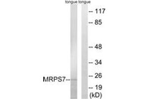 Western blot analysis of extracts from rat tongue cells, using MRPS7 Antibody.