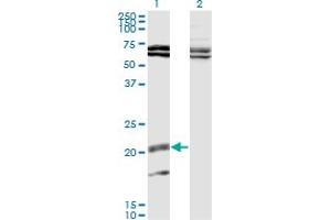 Western Blot analysis of IL17B expression in transfected 293T cell line by IL17B monoclonal antibody (M02), clone 1G6. (IL17B Antikörper  (AA 23-122))