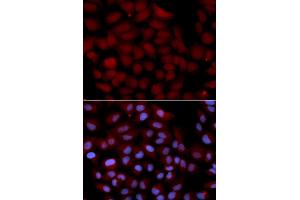 Immunofluorescence analysis of U2OS cells using TNK2 antibody (ABIN5971357). (TNK2 Antikörper)