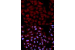 Immunofluorescence analysis of U2OS cells using TNK2 antibody (ABIN5971357). (TNK2 Antikörper)