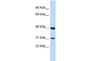 WB Suggested Anti-ZNF660 Antibody Titration:  0. (ZNF660 Antikörper  (N-Term))
