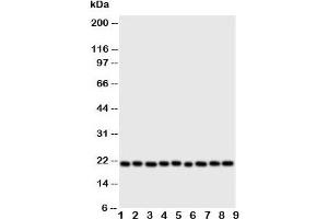 Western blot testing of Cytoglobin antibody and Lane 1:  rat brain;  2: (r) small intestine;  3: (r) liver;  4: (r) kidney;  5: human SGC;  6: (h) COLO320;  7: SMMC-7721;  8: PANC;  9: HeLa cell lysate. (CYGB Antikörper  (N-Term))