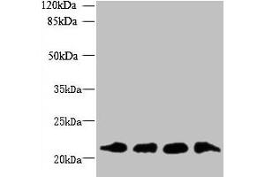 Western blot All lanes: MRPL18 antibody at 8 μg/mL Lane 1: U251 whole cell lysate Lane 2: THP-1 whole cell lysate Lane 3: PC-3 whole cell lysate Lane 4: U87 whole cell lysate Secondary Goat polyclonal to rabbit IgG at 1/10000 dilution Predicted band size: 21 kDa Observed band size: 21 kDa (MRPL18 Antikörper  (AA 14-180))