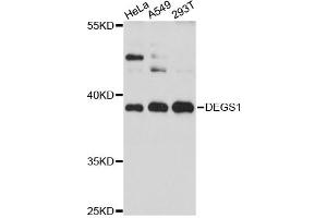 Western blot analysis of extracts of various cell lines, using DEGS1 antibody (ABIN6294024) at 1:3000 dilution. (DEGS1 Antikörper)