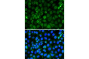 Immunofluorescence analysis of A549 cells using HIST2H4B antibody (ABIN5974305). (Histone Cluster 2, H4b (HIST2H4B) Antikörper)