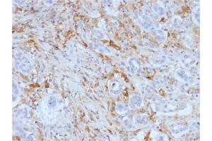 Formalin-fixed, paraffin-embedded human Pancreas stained with Ferritin, Light Chain Monoclonal Antibody (FTL/1388).