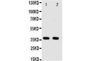 Anti-Annexin A10 antibody, Western blotting Lane 1: A549 Cell Lysate Lane 2: A549 Cell Lysate (Annexin a10 Antikörper  (C-Term))
