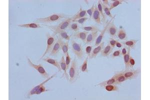 Immunocytochemistry analysis of Hela cells using ABIN7139671 at dilution of 1:100 (HIST1H3A Antikörper  (3meLys4))