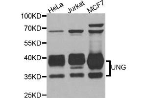 Western blot analysis of extracts of various cell lines, using UNG antibody. (UNG Antikörper)
