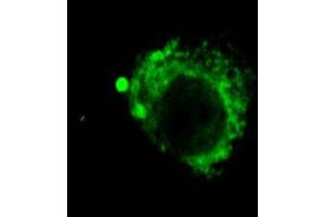 LAMP2 (GL2A7), IF showing distribution of lysosomes in CEC  Courtesy of Eunduck E P Kay, Doheny Eye Institue. (LAMP2 Antikörper)