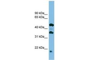 Image no. 1 for anti-Chromosome 11 Open Reading Frame 73 (C11orf73) (C-Term) antibody (ABIN6745127) (C11orf73 Antikörper  (C-Term))