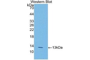 Western Blotting (WB) image for anti-Lysyl Oxidase-Like 2 (LOXL2) (AA 53-160) antibody (ABIN1176463)