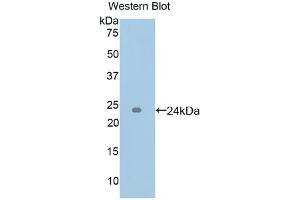 Western blot analysis of the recombinant protein. (ICAM4 Antikörper  (AA 52-234))