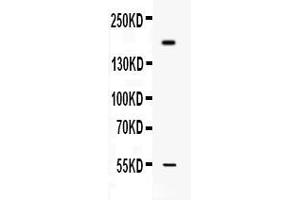 Western blot analysis of Collagen I expression in MCF-7 whole cell lysates ( Lane 1). (COL1A1 Antikörper  (C-Term))