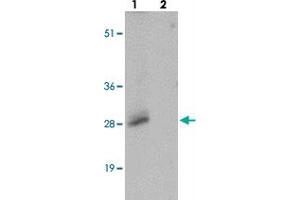 Western blot analysis of SHISA3 in human small intestine tissue with SHISA3 polyclonal antibody  at 1 ug/mL in (lane 1) the absence and (lane 2) the presence of blocking peptide. (SHISA3 Antikörper  (Internal Region))