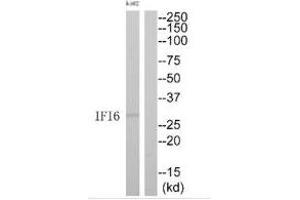 Western blot analysis of extracts from K562 cells, using IFI6 antibody. (IFI6 Antikörper  (C-Term))