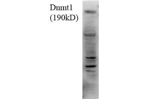 Western Blot analysis of Human H1299 cell lysate showing detection of DNMT1 protein using Mouse Anti-DNMT1 Monoclonal Antibody, Clone 4G11-C7 . (DNMT1 Antikörper  (AA 620-950) (APC))