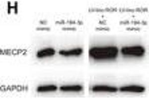 linc-ROR promoted cell proliferation, migration, and invasion of breast cancer through linc-ROR/miR-194-3p/MECP2 regulatory axis. (MECP2 Antikörper  (AA 1-100))