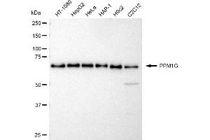 Western blotting analysis using PPM1G antibody (ABIN7800035). (Rekombinanter PPM1G Antikörper)